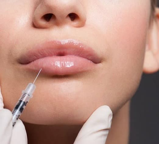 Dermal Filler in St. Clair, MO: What to Know Before Your First Appointment
